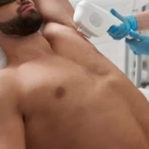 COMBO 7: BUÇO + QUEIXO + AXILAS 999 POR 799 IMPERDÍVEL (MASCULINO) 2398 POR 1899