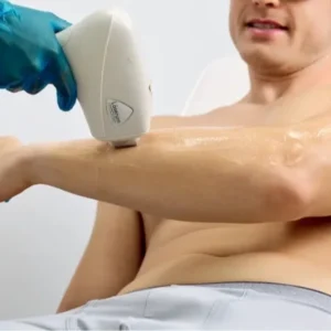 BRAÇOS COMPLETOS 1129 POR 899 (MASCULINO) 4999 POR 3999 IMPERDIVEL