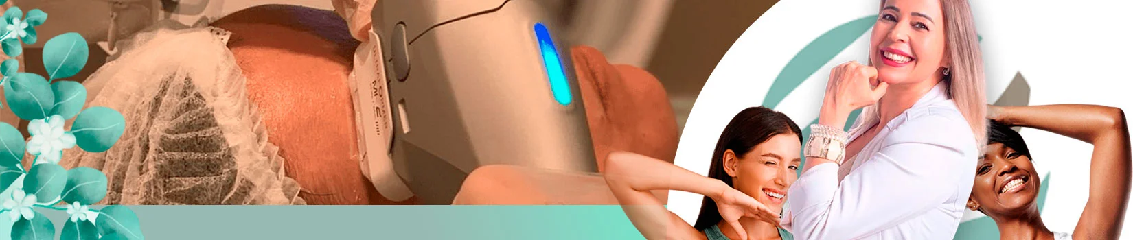 Concept Laser