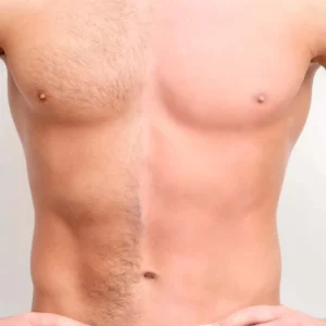 PEITO+ABDÔMEN MASCULINO 1290 POR 999