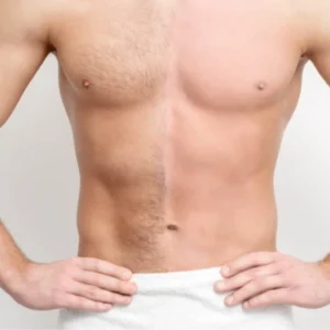 COMBO 10: AXILAS + BUÇO + QUEIXO + VIRILHA + PERIANAL + 1/2 PERNA. 2699 POR 2129 (MASCULINO) 4999 POR 3999 IMPERDIVEL
