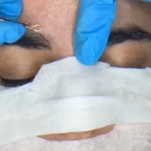 40% DE DESCUENTO EN LIMPIEZA DE CUTIS Y DRENAJE LINFÁTICO